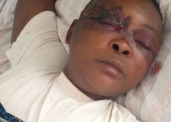 Man Injures Wife in Nkhotakota